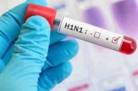 وزارة الصحة: لا انفلونزا خنازير في اربد والوفاة بسبب التهاب رئوي حاد